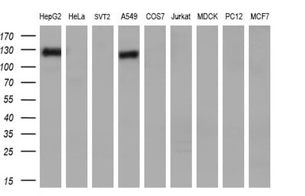 ANPEP / CD13 Antibody (aa668-967, clone OTI2E4)