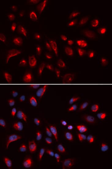 CHRM5 / M5 Antibody