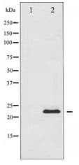 BAD Antibody