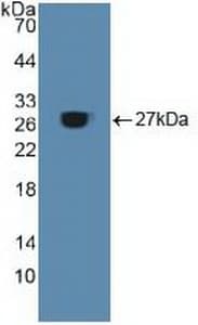 ACO1 / Aconitase Antibody (aa251-443, Biotin)