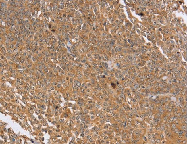 Polyclonal Rabbit anti-Human PTPN20 Antibody (IHC, WB)