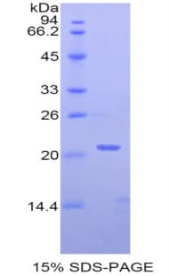 Human PPARD / PPAR Delta Protein (Recombinant His, N-Terminal)