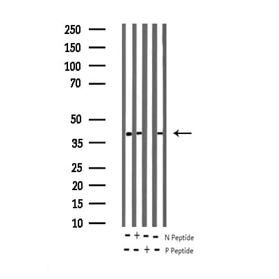 Polyclonal Rabbit anti-Human MAP2K1 / MKK1 / MEK1 Antibody (phospho-Thr291, IF, WB)