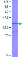 Human CYP46A1 / CYP46 Protein (Recombinant GST, N-terminus)