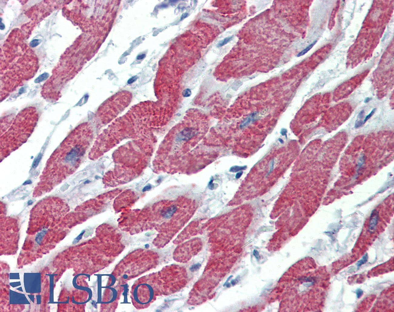 PathPlus™ Polyclonal Rabbit anti-Human ACVR2 / ACVR2A Antibody (IHC, WB)