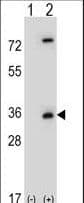 Polyclonal Rabbit anti-Human CASP3 / Caspase 3 Antibody (aa149-179, IHC, WB)