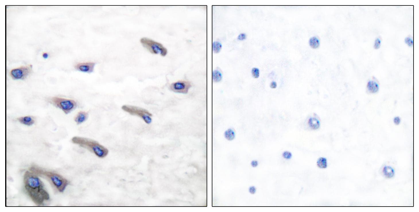PDGFRB / PDGFR Beta Antibody (phospho-Tyr751)