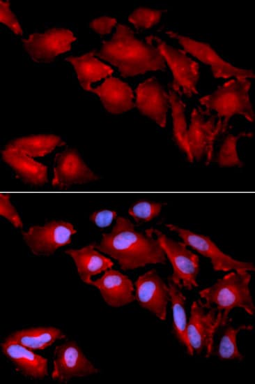 CTNND1 / p120 Catenin Antibody