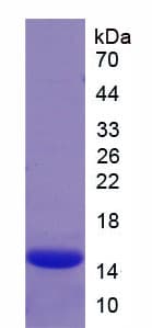 Human CFB / Complement Factor B Protein (Recombinant His)