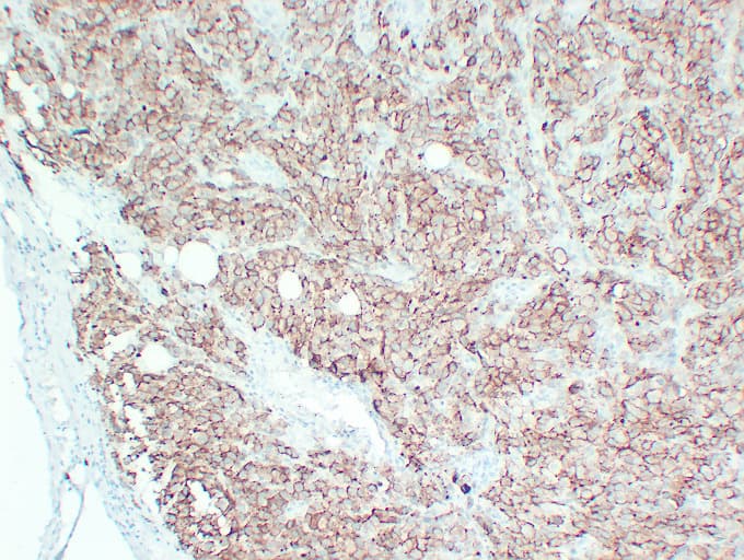 CD63 Antibody (clone ABT-CD63)