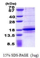 Human C1D Protein (Recombinant His)