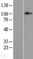 MED24 / TRAP100 Protein (Over-Expression Lysate Myc-DDK (Flag))