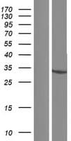 HSDL1 Protein (Over-Expression Lysate Myc-DDK (Flag))