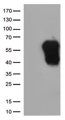 Monoclonal Mouse anti-Human HAVCR2 / TIM-3 Antibody (clone OTI2F11, Carrier-free, WB)