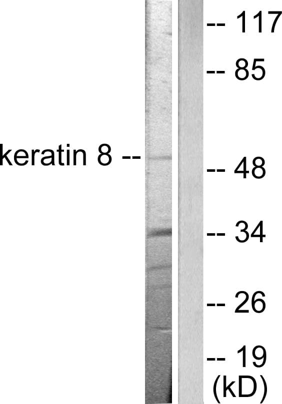 IHC-plus™ KRT8 / CK8 / Cytokeratin 8 Antibody (aa434-483)