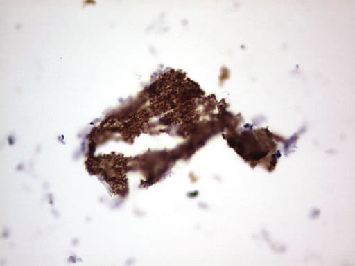 Monoclonal Mouse anti-Human NCAM / CD56 Antibody (clone OTI1B9, Carrier-free, aa20-718, IHC, WB)