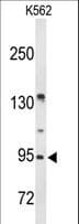 BRINP3 / FAM5C Antibody (aa40-68)