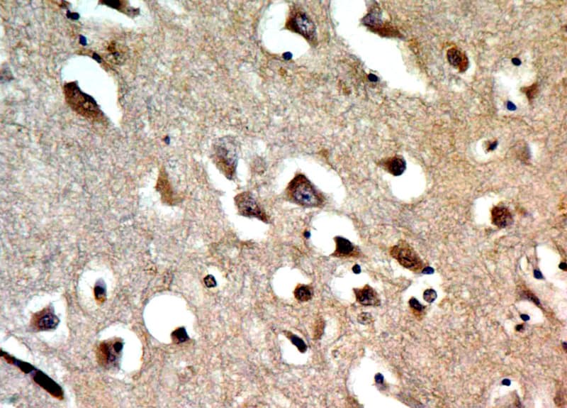 TNFRSF9 / 4-1BB / CD137 Antibody