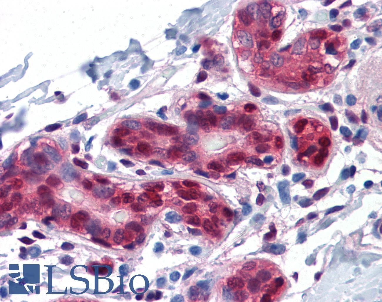IHC-plus™ YAP / YAP1 Antibody (clone 2H1)