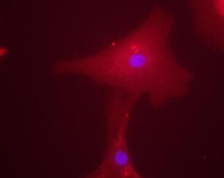 MLXIPL / CHREBP Antibody (aa50-150, Biotin)