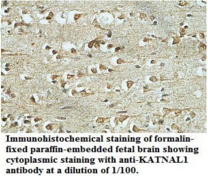 Polyclonal Rabbit anti-Human KATNAL1 Antibody (aa2-168, IHC, WB)