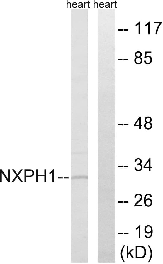 IHC-plus™ NXPH1 Antibody (aa77-126)