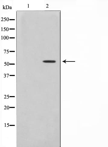 Polyclonal Rabbit anti-Human TRIM38 Antibody (IF, WB)