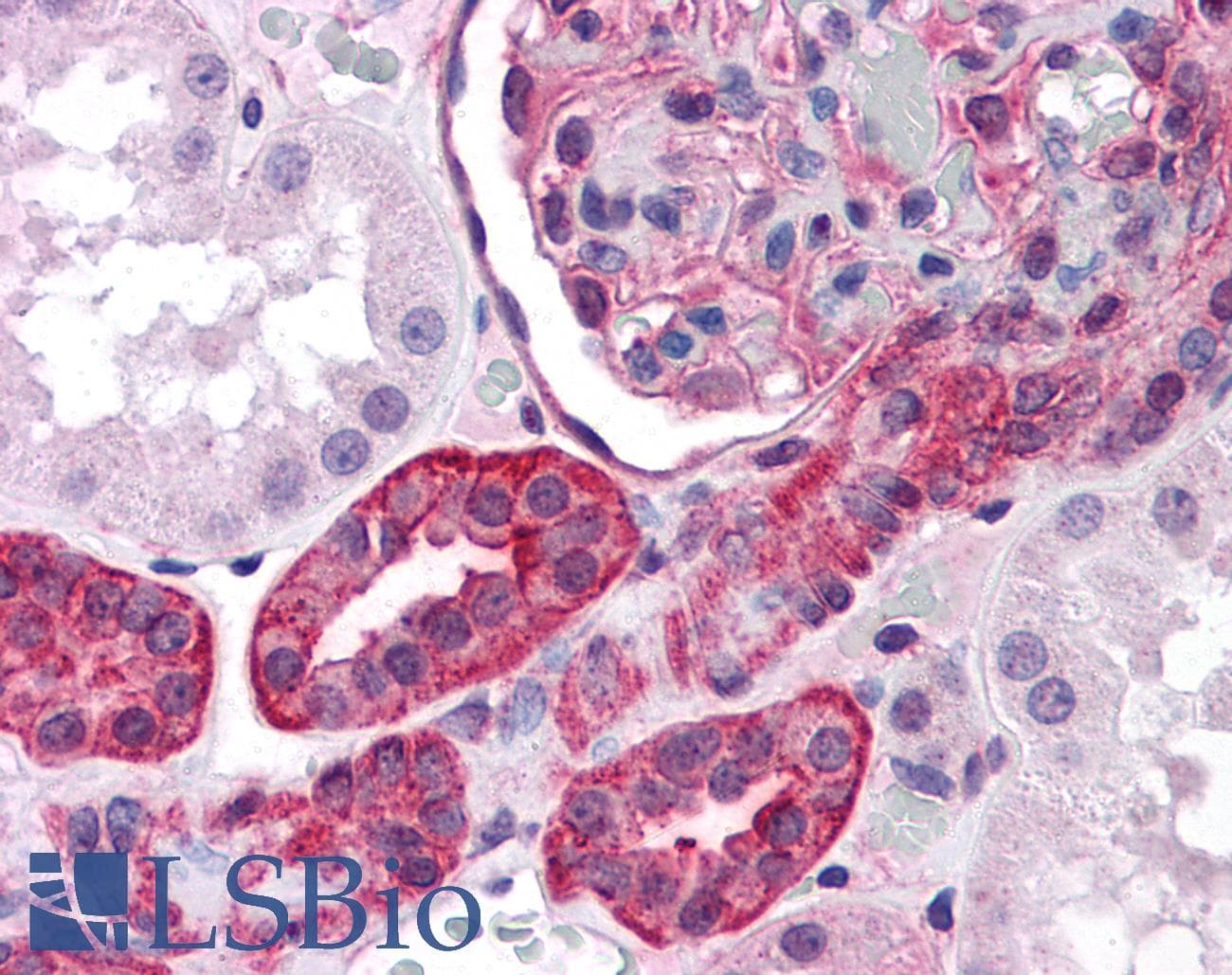 IHC-plus™ ZNF521 Antibody