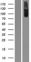 Human CHUK / IKKA / IKK Alpha Protein (Over-Expression Lysate Myc-DDK (Flag))