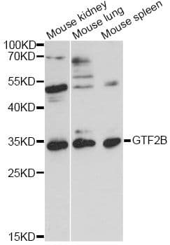 TFIIB Antibody