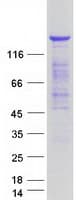 Human TBC1 / TBC1D1 Protein (Recombinant Myc-DDK (Flag))