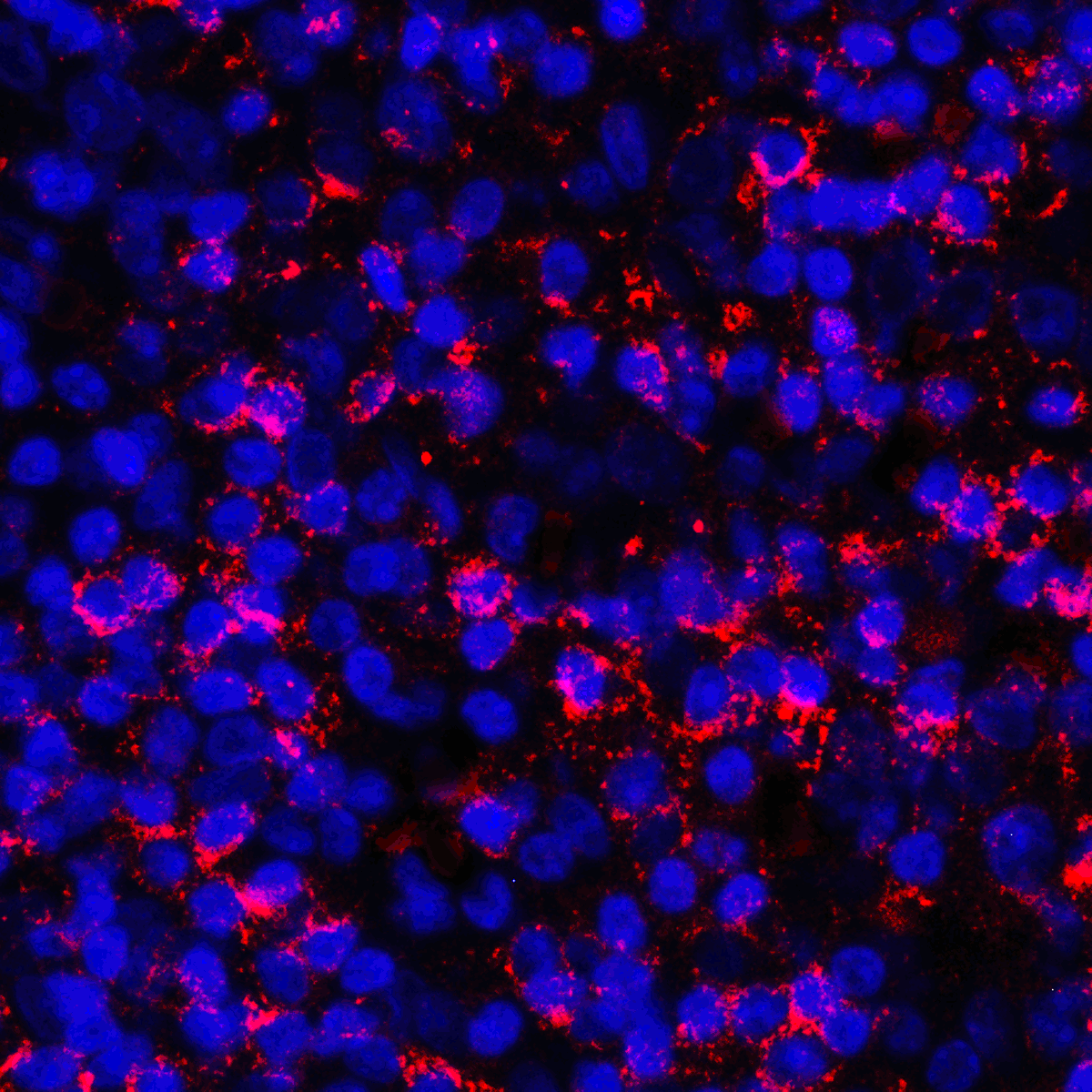 CD274 / B7-H1 / PD-L1 Antibody (clone 8E12)