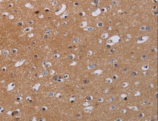 Polyclonal Rabbit anti-Human MKKS Antibody (IHC)