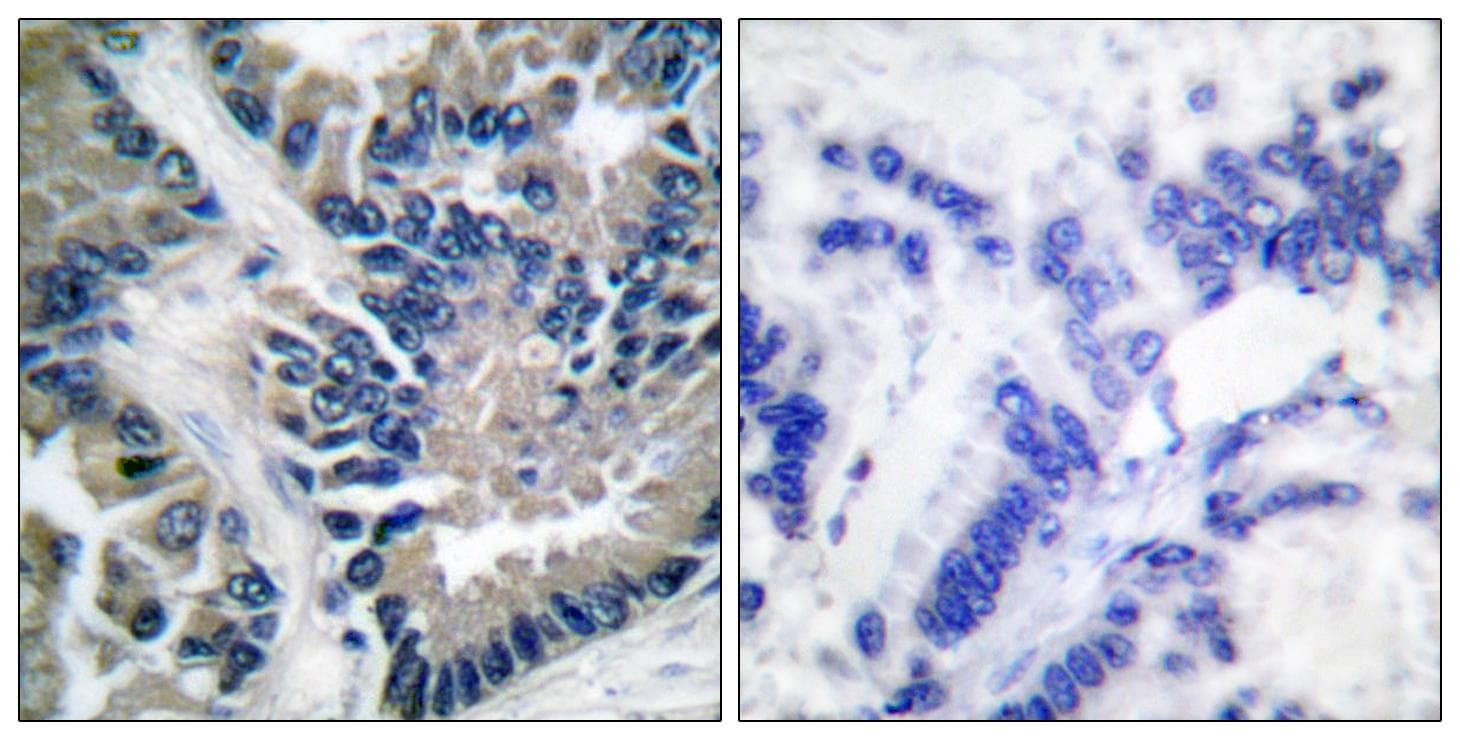 STAT2 Antibody (p690)