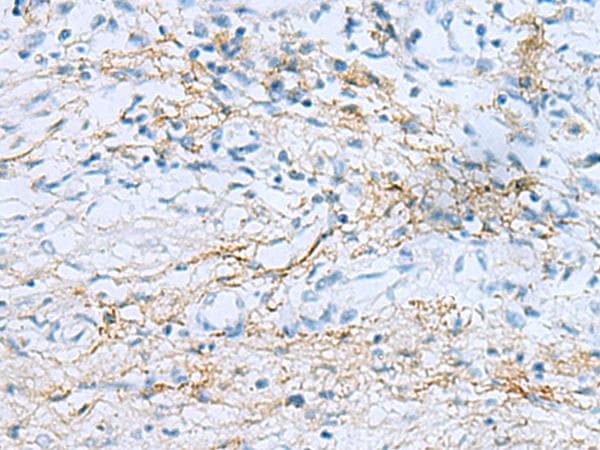 EMILIN1 / EMI Antibody