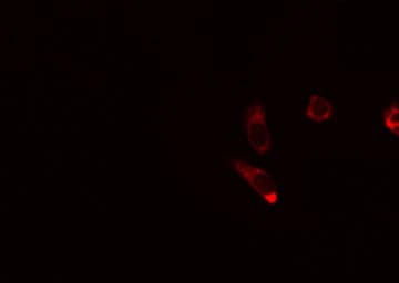 AKAP1 / AKAP Antibody