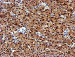 Monoclonal Mouse anti-Human Mannose Phosphate Isomerase Antibody (clone OTI4E7, IHC, WB)