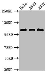 ECT2 Antibody