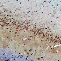 Polyclonal Rabbit anti-Human CACNG2 / Stargazin Antibody (IHC, WB)