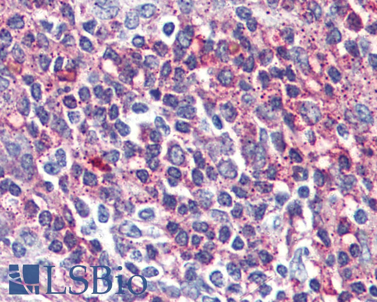 IHC-plus™ VPAC2 / VIPR2 Antibody (Internal)