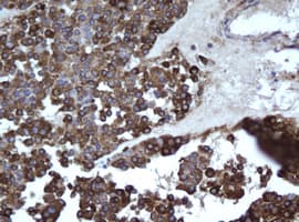 EPHX1 / Epoxide Hydrolase 1 Antibody (clone OTI3A10)