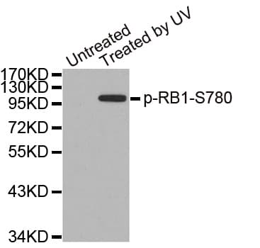 RB1 / Retinoblastoma / RB Antibody (phospho-Ser780)