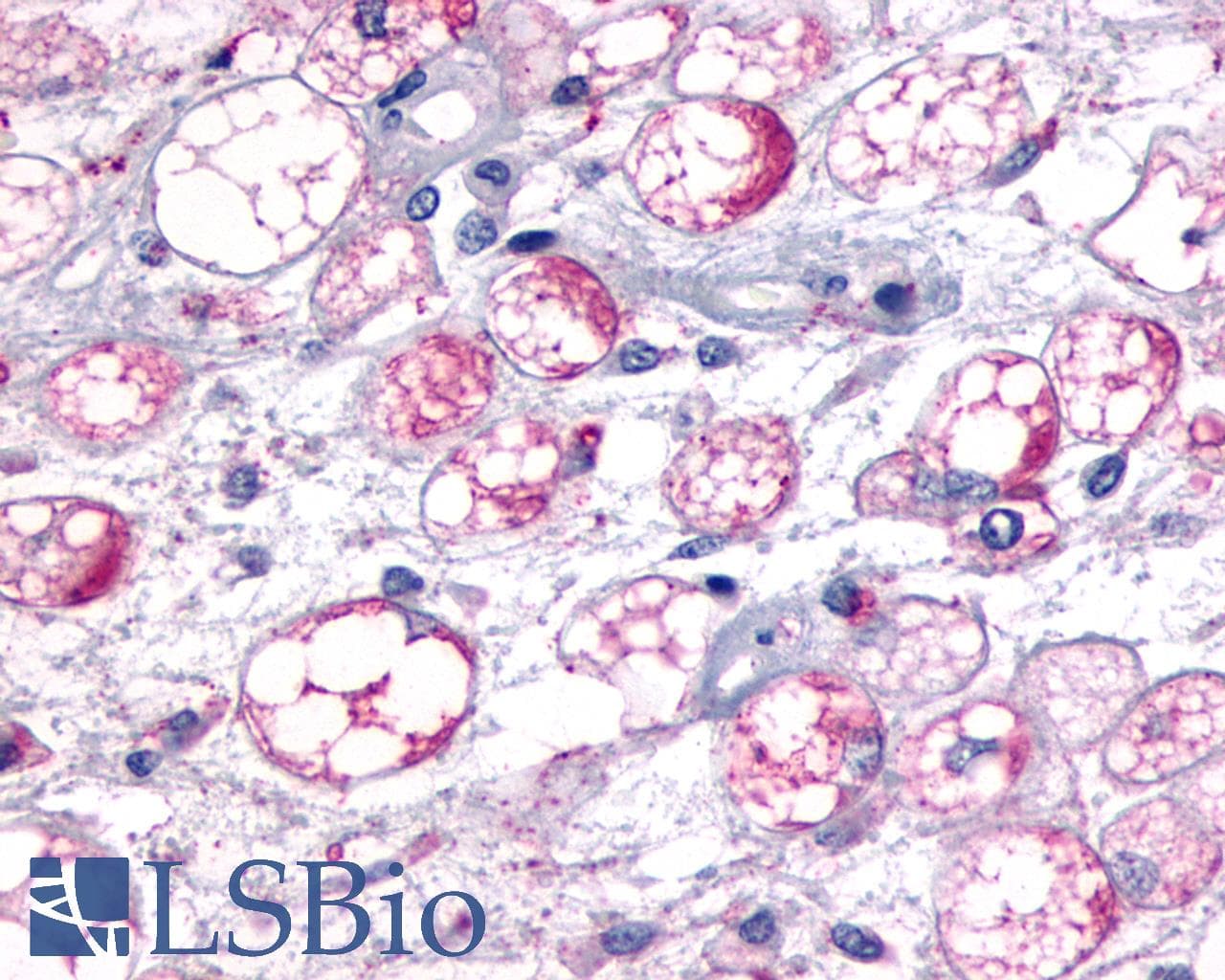 PathPlus™ Polyclonal Rabbit anti-Human MCHR1 Antibody (N-Terminus, IHC)