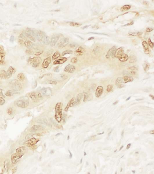 Polyclonal Rabbit anti-Human PYGO1 / Pygopus 1 Antibody (aa300-350, IHC)