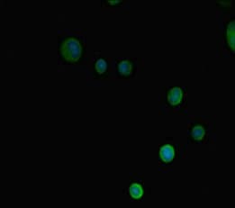 Polyclonal Rabbit anti-Human PRMT3 Antibody (IHC, IF, WB)