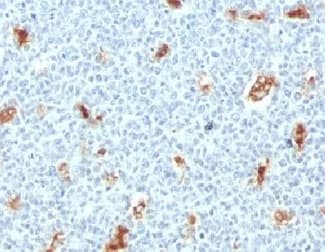 S100A9 / MRP14 Antibody (clone PS1A9-1)