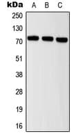 ITIH2 Antibody (Internal)