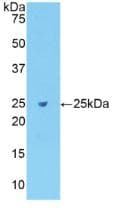 FN1 / Fibronectin Antibody (aa355-558)