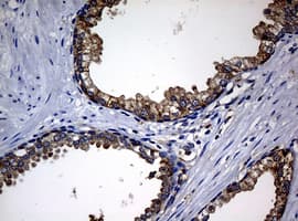 Monoclonal Mouse anti-Human NME1 / NM23 Antibody (clone OTI7F2, IHC, WB)
