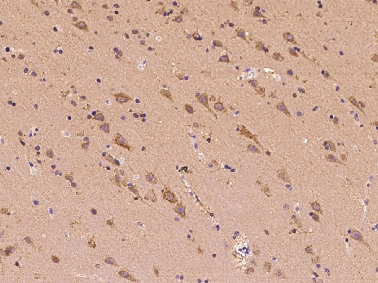 CLVS2 Antibody